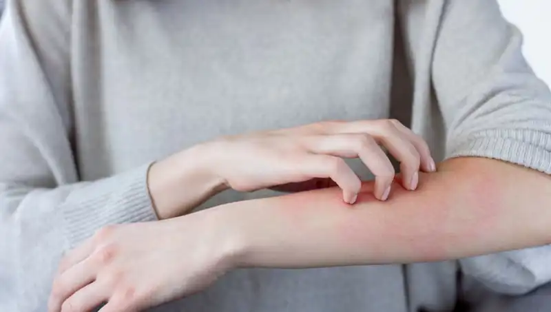 Cilt Kanserinin Gizli Belirtileri: Dermatologdan Kritik Uyarılar